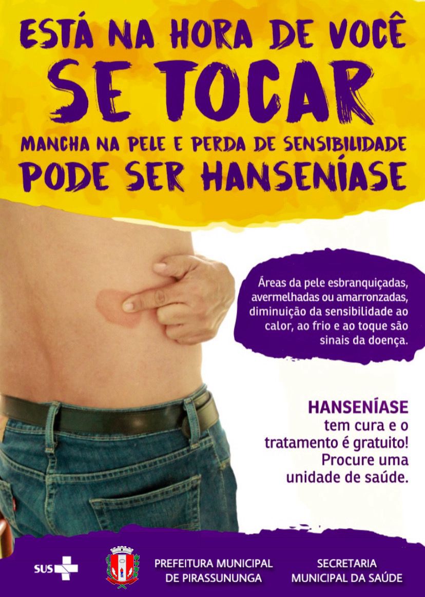 banner EST&Aacute; NA HORA DE SE TOCAR