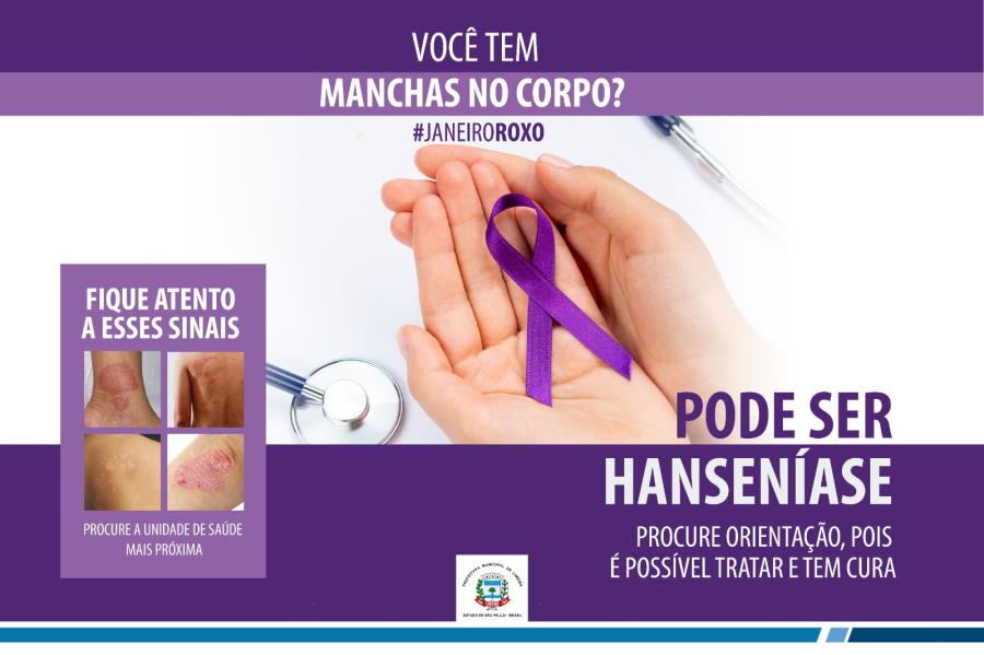 Secretaria de Saúde orienta sobre prevenção à hanseníase