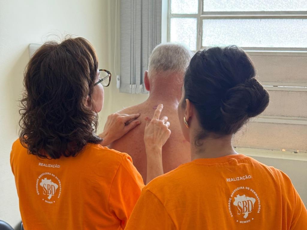 Hospital Municipal realiza ação de reastreamento e identifica 65 pacientes com suspeita de câncer de pele