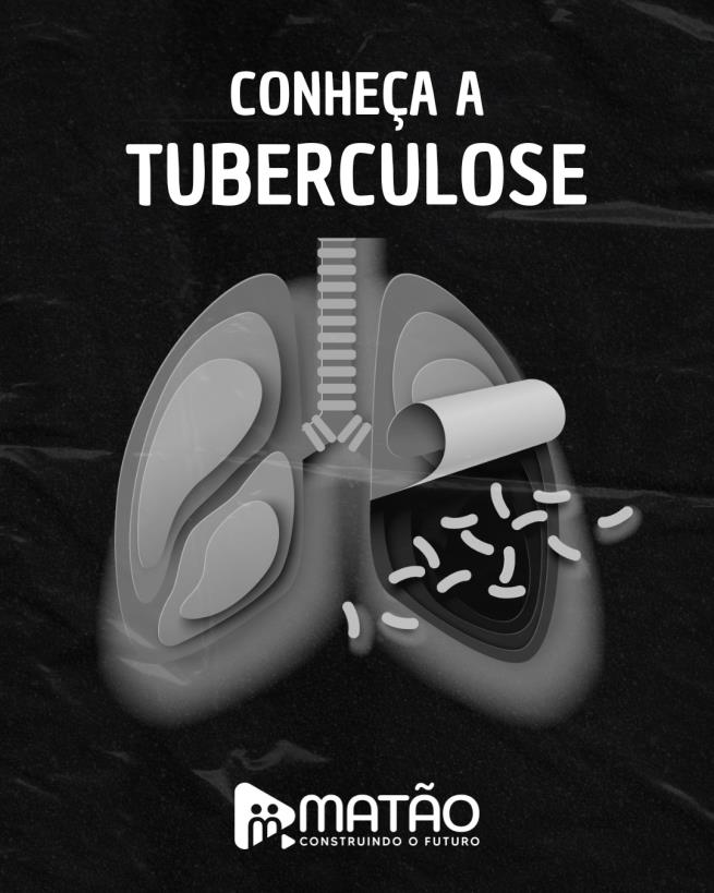 Prefeitura de Matão intensifica ações de combate à tuberculose