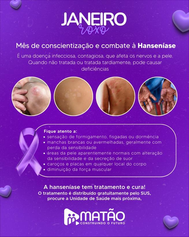Campanha ‘Janeiro Roxo’ orienta sobre tratamento da hanseníase