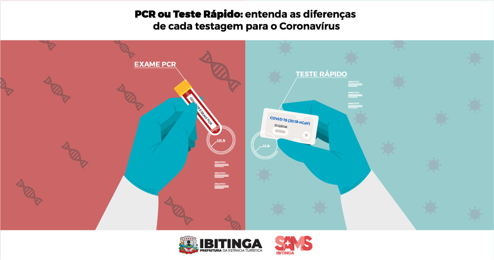 Coronavírus: Exame de PCR para COVID-19 no RJ