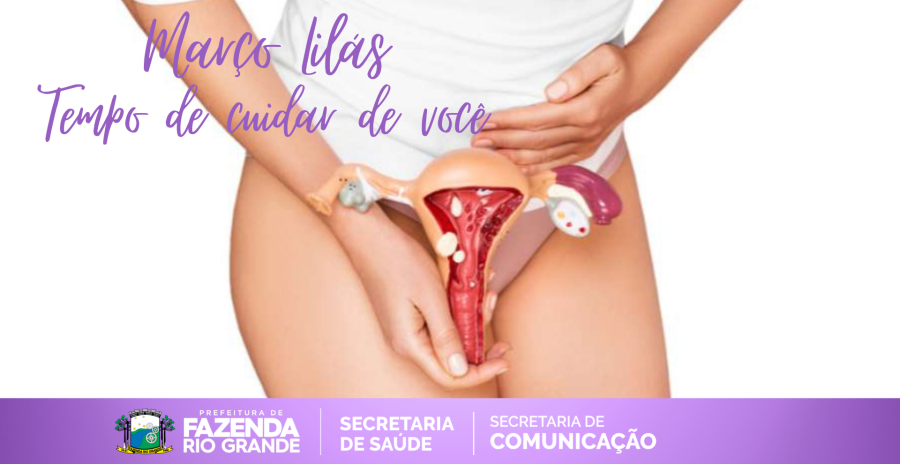 Março Lilás: como se prevenir do câncer do colo do útero