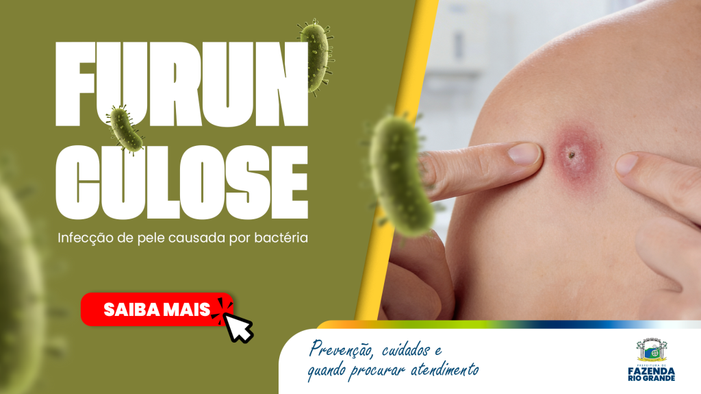 Prefeitura orienta população sobre cuidados e prevenção contra a Furunculose