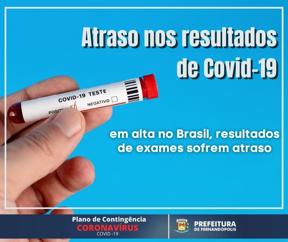 Testes COVID-19 em SP: Exames para coronavírus