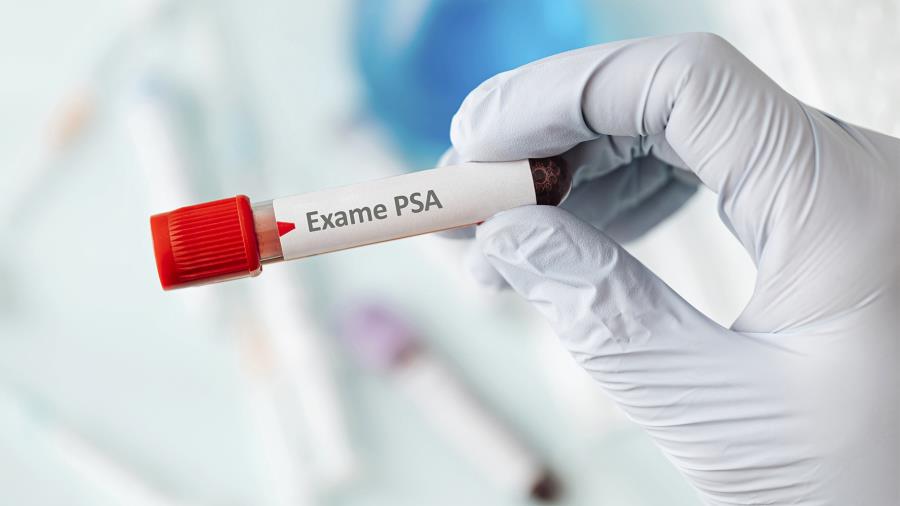 Jarinu promove mutirão de coleta de exames PSA neste sábado (27)