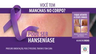 Hanseníase