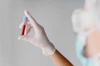 ANEMIA