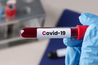 cirurgiao-segurando-um-tubo-de-ensaio-de-sangue-para-coronavirus_53876-95286