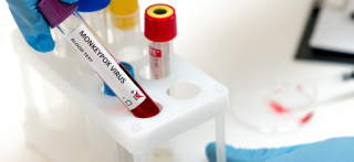 MINISTÉRIO DA SAÚDE APRESENTA CENÁRIO EPIDEMIOLÓGICO DA MONKEYPOX_16-08-2022