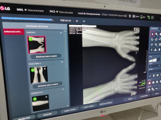 52 - Raio-X Digital para UPA Municipal, aquisição que garante exames mais precisos para o diagnóstico médico