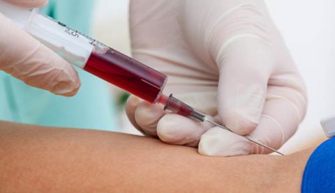 Dia Mundial de Conscientização sobre a Doença Falciforme reforça a importância do diagnóstico precoce e do acompanhamento especializado